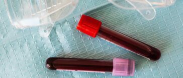 Cinsel Yolla Bulaşan Hastalıklar