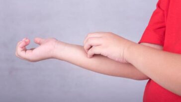 Egzama nedir? Egzama Nasıl Geçer?