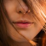 Dudak çatlaması neden olur? Nasıl Tedavi edilir?