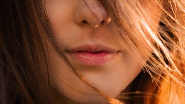 Dudak çatlaması neden olur? Nasıl Tedavi edilir?